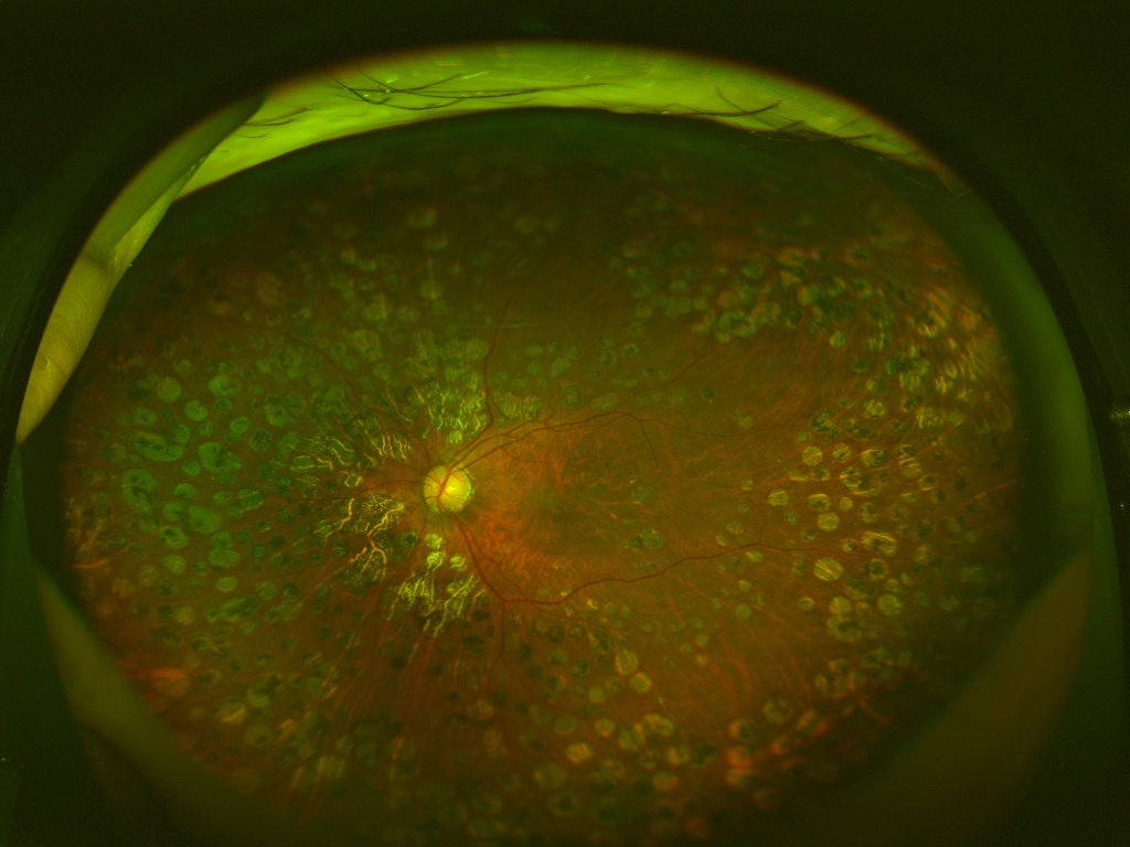 眼底画像所見を読み解く OCT・OCT angiography｜久里浜眼科